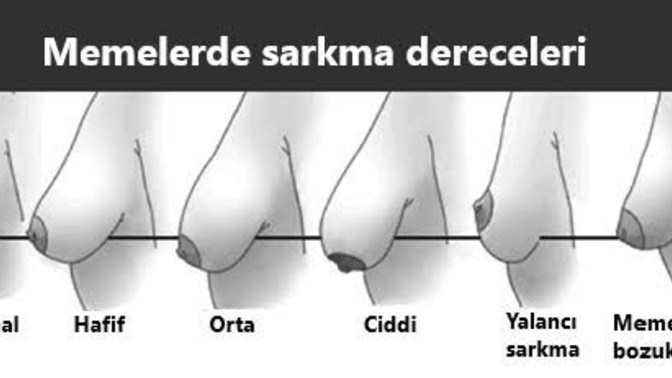 Sarkık meme için ameliyatsız bir çözümden bahset?