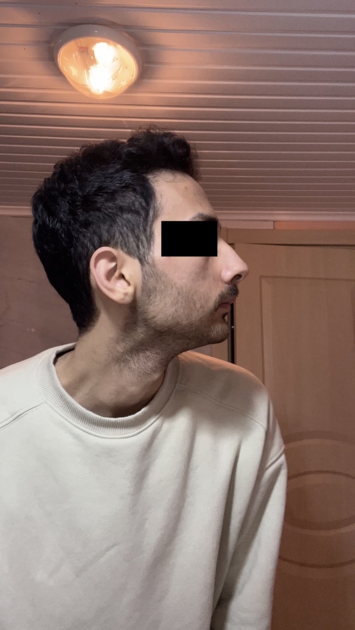 Çene yapımdan hiç memnun değilim. Lütfen ciddi yardımcı olun?