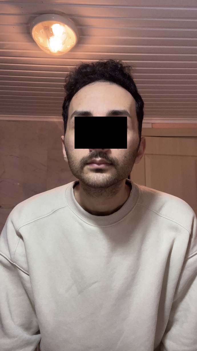 Çene yapımdan hiç memnun değilim. Lütfen ciddi yardımcı olun?