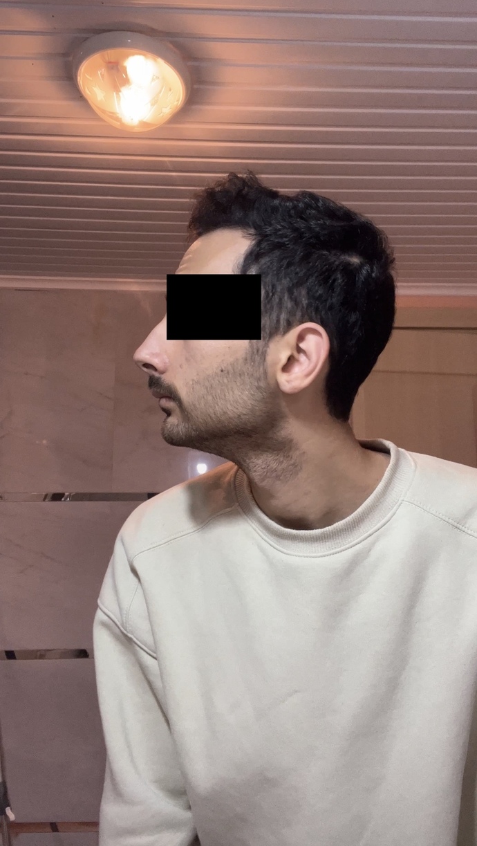 Çene yapımdan hiç memnun değilim. Lütfen ciddi yardımcı olun?