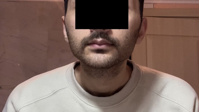 Çene yapımdan hiç memnun değilim. Lütfen ciddi yardımcı olun?