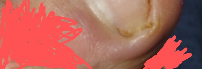 Lütfen bilgisi olanlar bi yardımcı olabilir mi acilen?