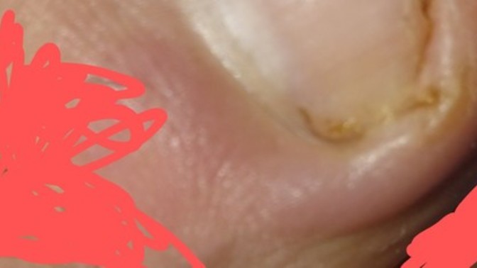 Lütfen bilgisi olanlar bi yardımcı olabilir mi acilen?