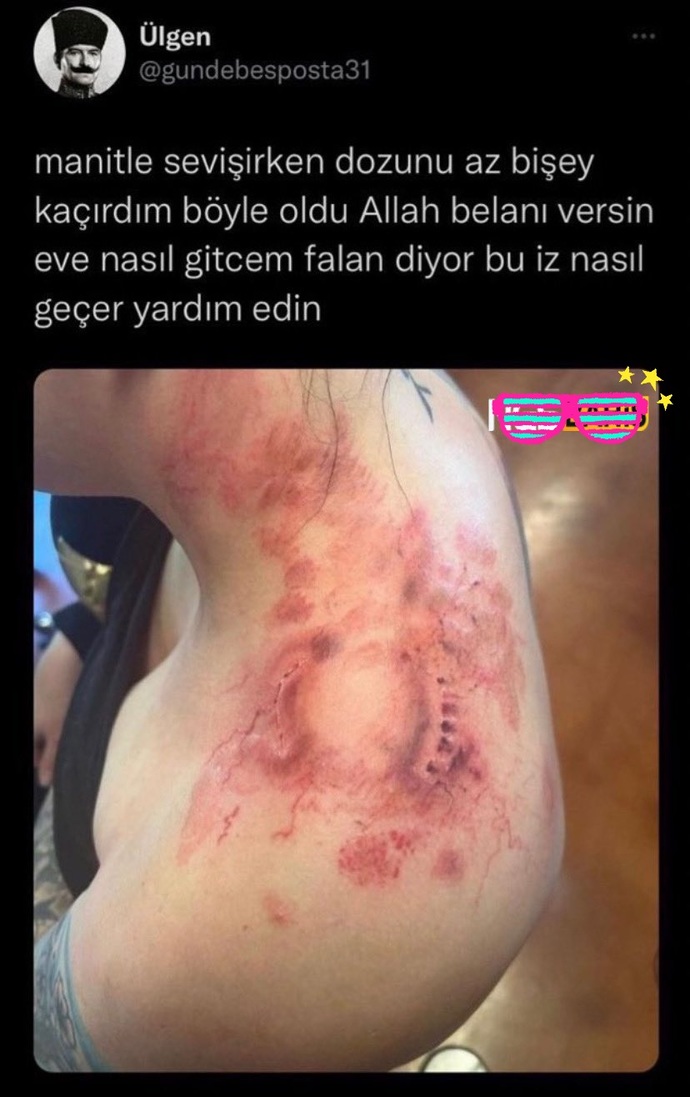 Yatakta sadistçe yaklaşımlara nasılsınızdır?