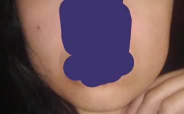 Yanağım için ne önerirsiniz? Resimli?