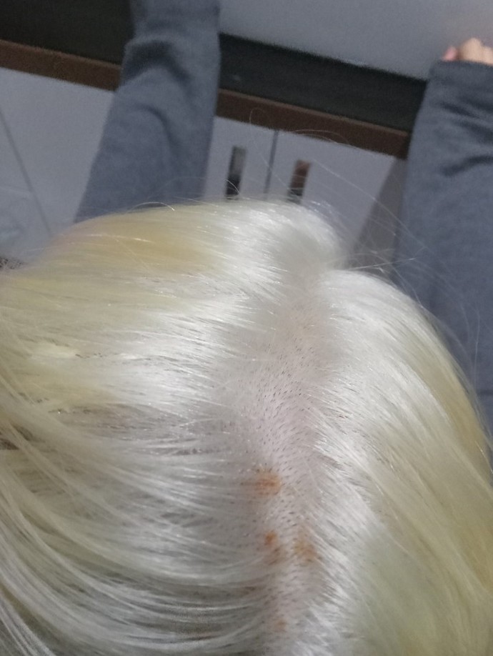 Saç beyaz/platine boyanınca saç derisinde bu yaraların olması normal mi?