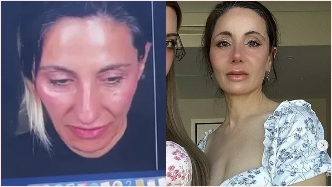 Mika Raun annesinin estetikle değişimini paylaştı! Sizce nasıl olmuş?