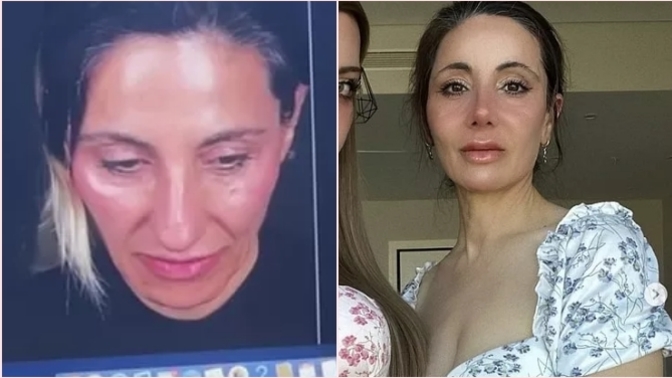 Mika Raun annesinin estetikle değişimini paylaştı! Sizce nasıl olmuş?