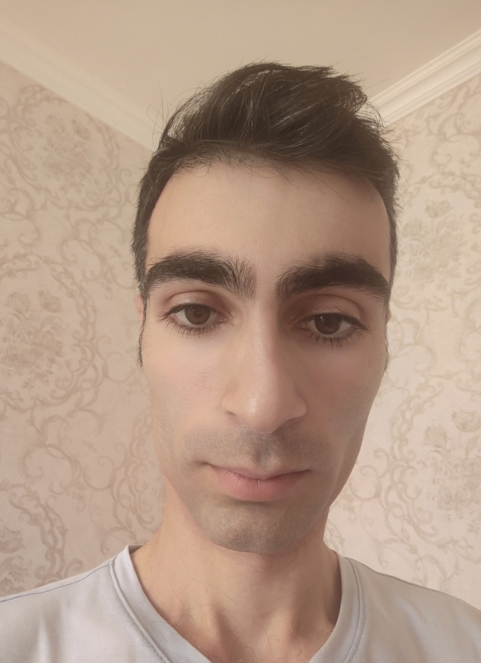 Saçımın ön hissesi seyrerlik oluşuyor hem de tarak bile vuramıyorum dökülür diye dikkat ediyorum sizce bir çare var mı?