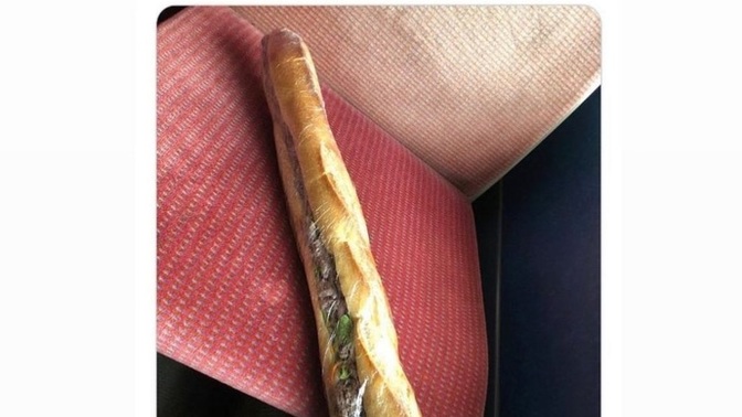 Acıkınca gözünüz döner mi 🙄?