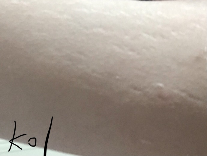 vücudumda sürekli çatlaklar oluştu özgüvenim aşırı düşük ne yapmam gerek cok üzülüyorum