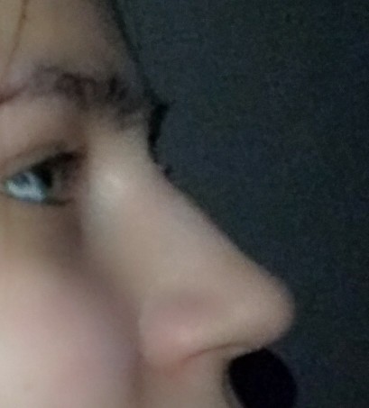 Burnumun estetiğe ihtiyacı var mı?