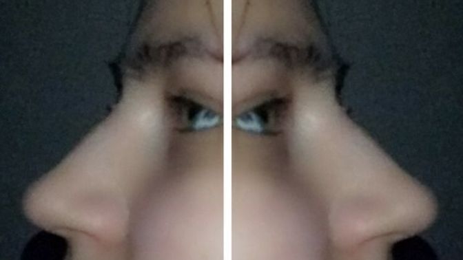 Burnumun estetiğe ihtiyacı var mı?