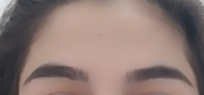 Kaşlar alındığı halde neden esit değiller aklım almıyor ikisi arasında fark belli oluyor mu?