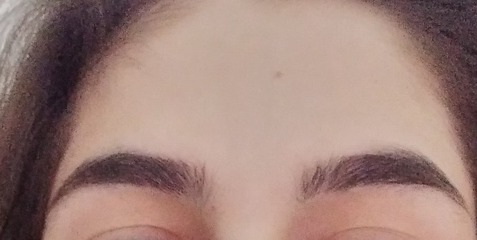 Kaşlar alındığı halde neden esit değiller aklım almıyor ikisi arasında fark belli oluyor mu?