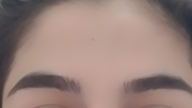Kaşlar alındığı halde neden esit değiller aklım almıyor ikisi arasında fark belli oluyor mu?