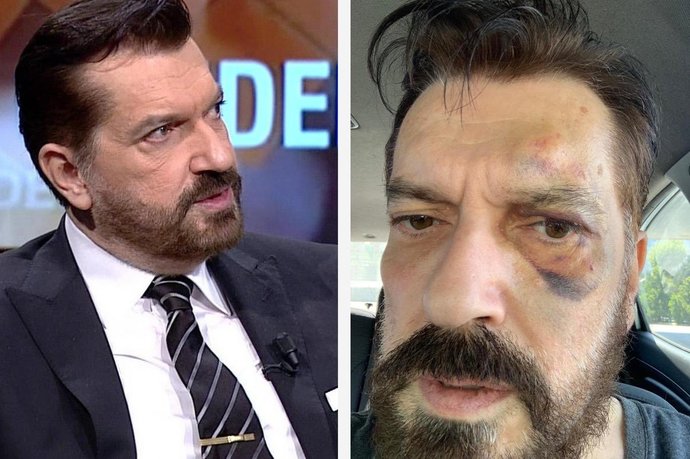😂 😂 Hakan Bayrakçının son anketi için ne düşünüyorsunuz?