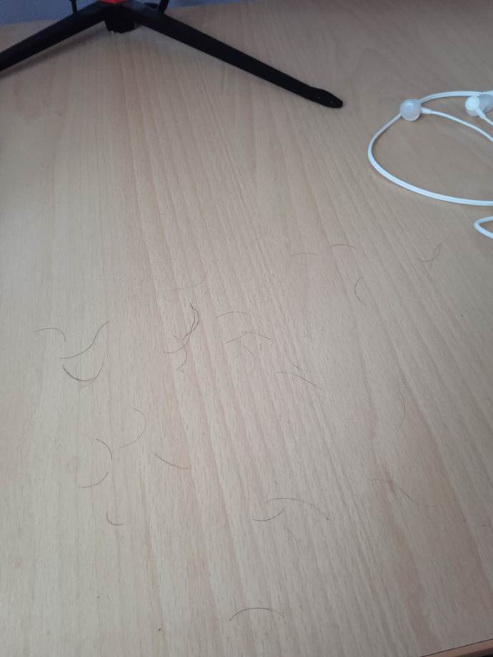 Saçımı sirkeledim ve bu kadar saç döküldü normal mi?