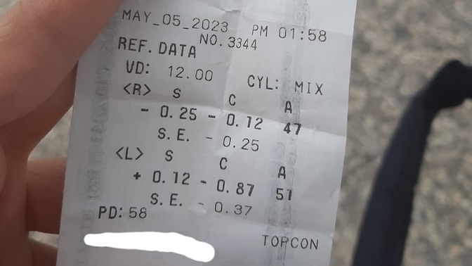 Bu göz dereceleri normal mi?