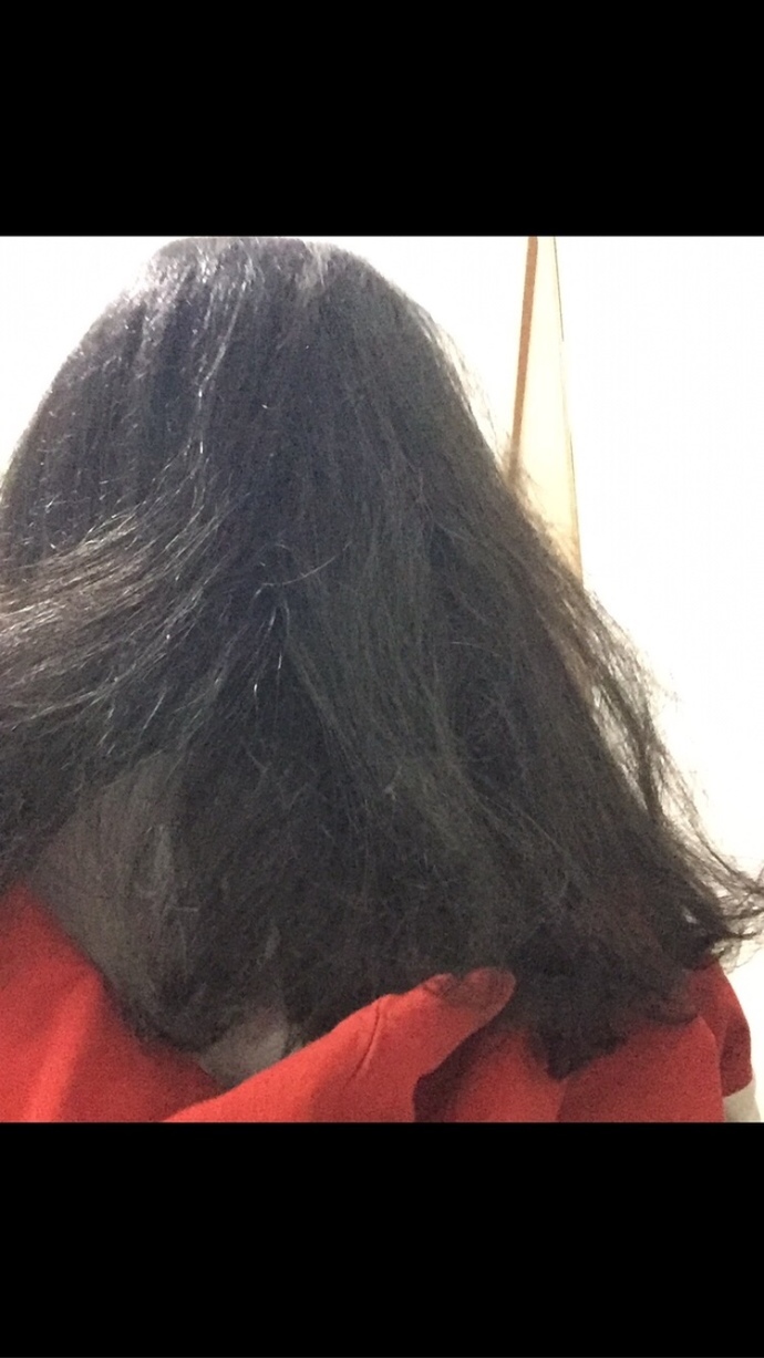 Saçlarıma hiç bakım yapmıyorum, sizce bakımsız mı duruyor? Ne uygulayabilirim, bir de son fotolarda kel gibi bir kısım normal mi?