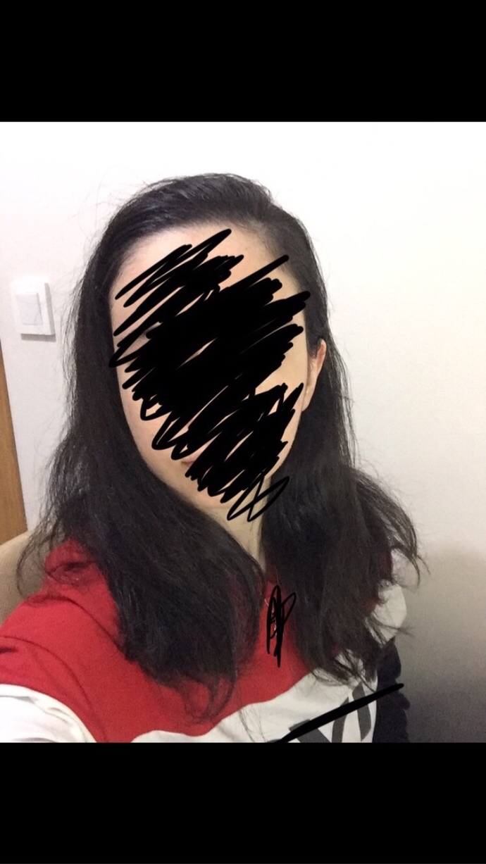 Saçlarıma hiç bakım yapmıyorum, sizce bakımsız mı duruyor? Ne uygulayabilirim, bir de son fotolarda kel gibi bir kısım normal mi?