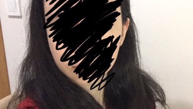 Saçlarıma hiç bakım yapmıyorum, sizce bakımsız mı duruyor? Ne uygulayabilirim, bir de son fotolarda kel gibi bir kısım normal mi?