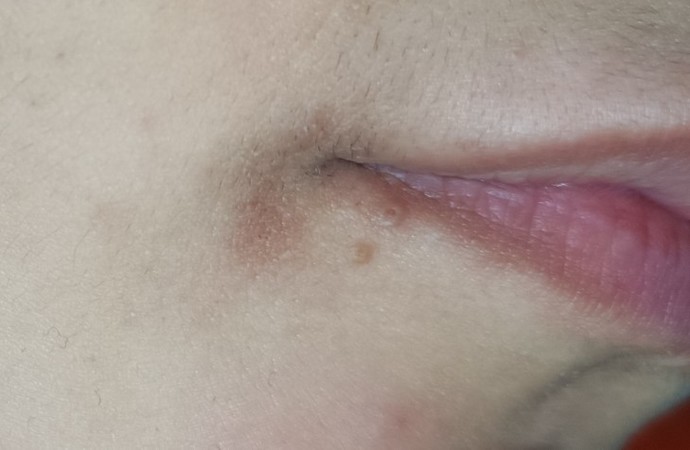 Bu leke durduk yere oluştu nasıl geçer?
