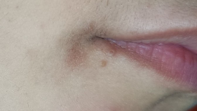 Bu leke durduk yere oluştu nasıl geçer?