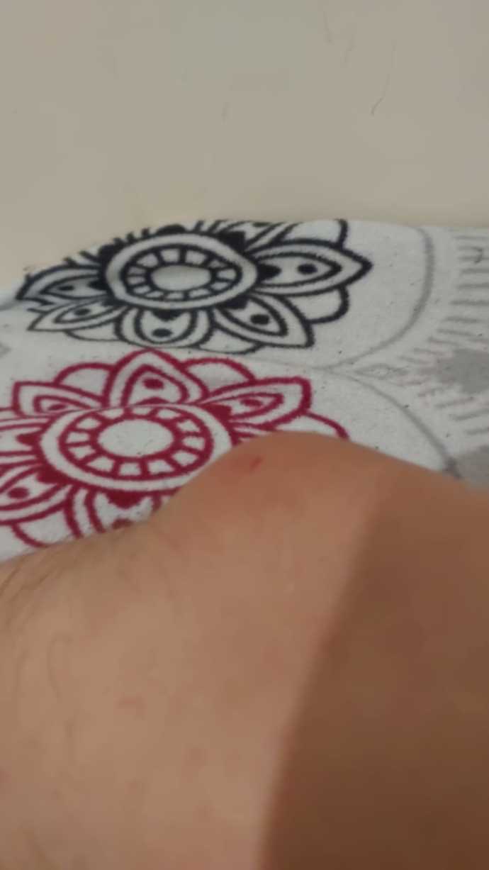 Kol dirseğimdeki bu şişlik ne olabilir, kendi kendine geçer mi, şırınga ile bunu çeksem olur mu acaba?