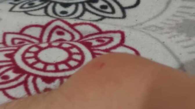 Kol dirseğimdeki bu şişlik ne olabilir, kendi kendine geçer mi, şırınga ile bunu çeksem olur mu acaba?