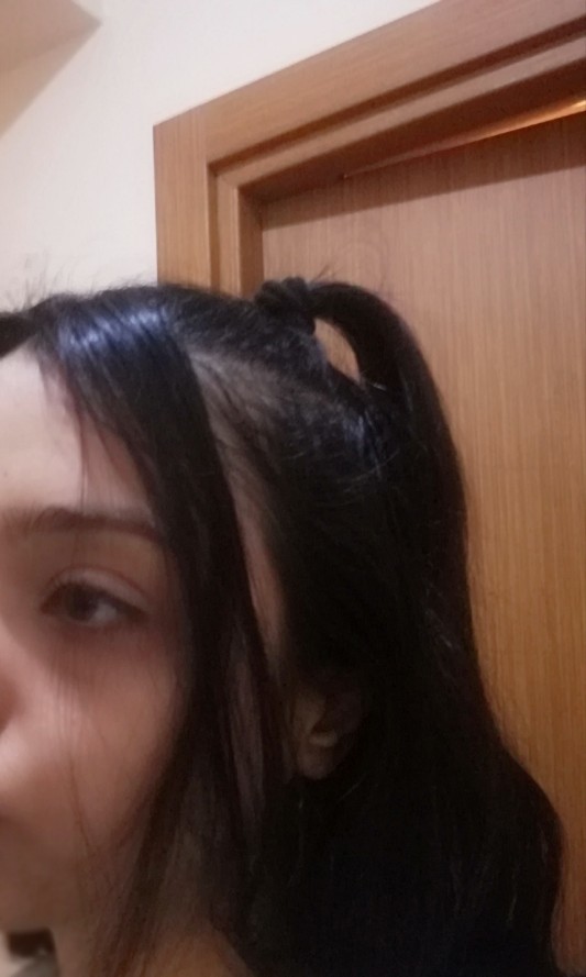 Saçımın önü çok mu seyrek?