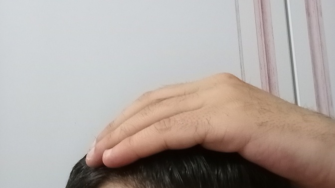 Sizce saçlarım dökülüyor mu? 