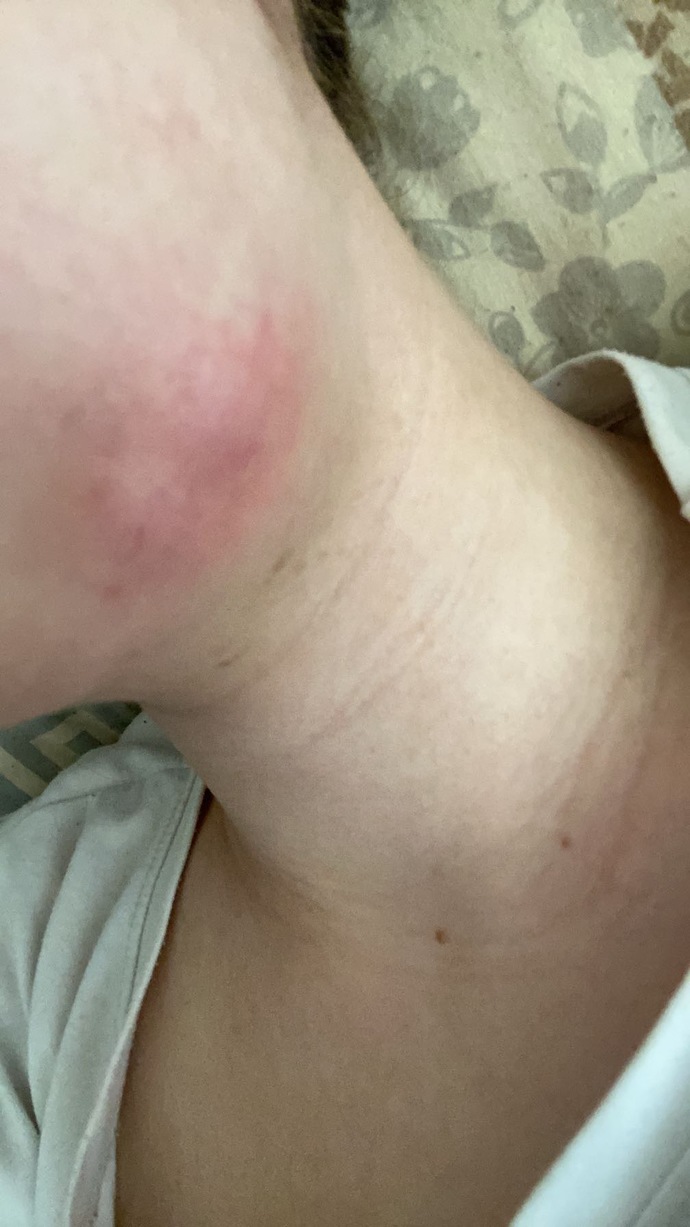 Diş apsem var, antibiyotik kullanıyorum ama bu şekilde olmaya devam ediyor. Neden olabilir?