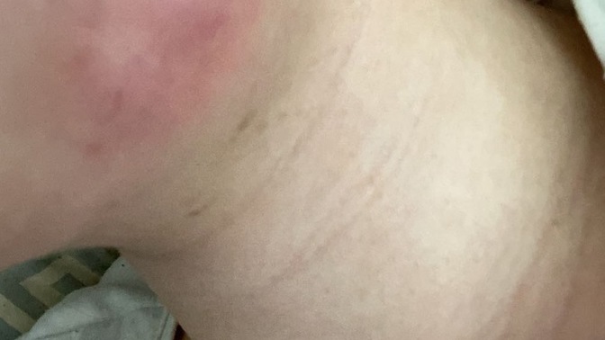 Diş apsem var, antibiyotik kullanıyorum ama bu şekilde olmaya devam ediyor. Neden olabilir?
