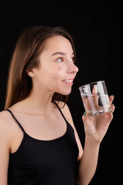 Günde 3 litreden fazla su içmek cilt kuruluğuna sebep olur mu?