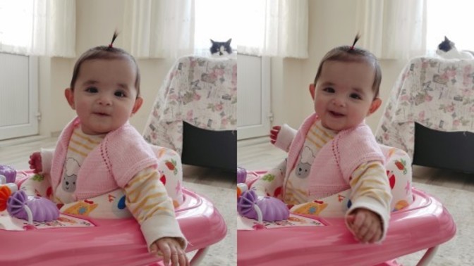 8 aylık kızımın tek anteni kötü mü olmuş? Saçlarını nasıl daha hızlı uzatabilirim👶🏻?