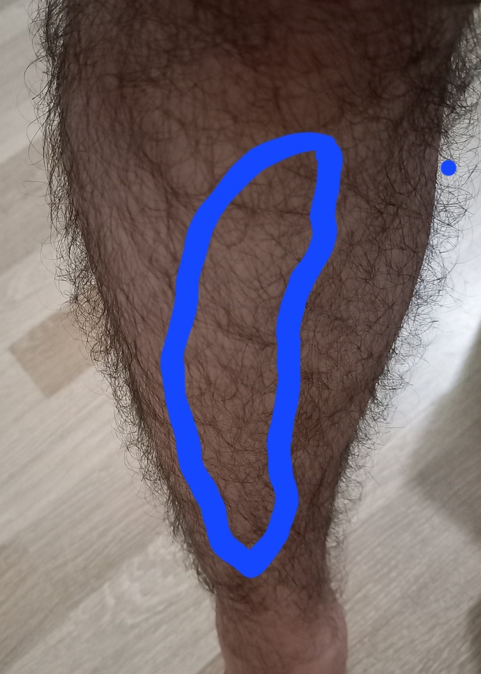 Bacağım çok ağrıyor, fizyoterapist veya doktor var mı?