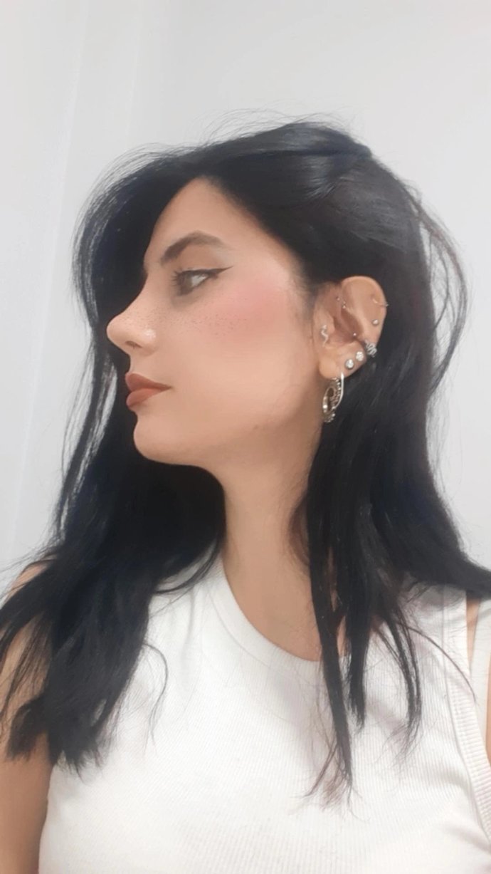 Burun estetiğim nasıl olmuş?