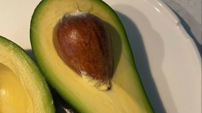 Avokado sever misin?