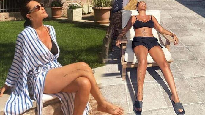 D vitamini sentezlemek için güneş ışını toplamaya başladınız mı?
