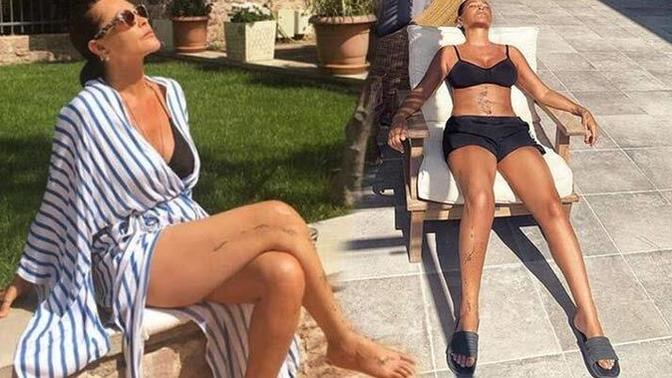 D vitamini sentezlemek için güneş ışını toplamaya başladınız mı?