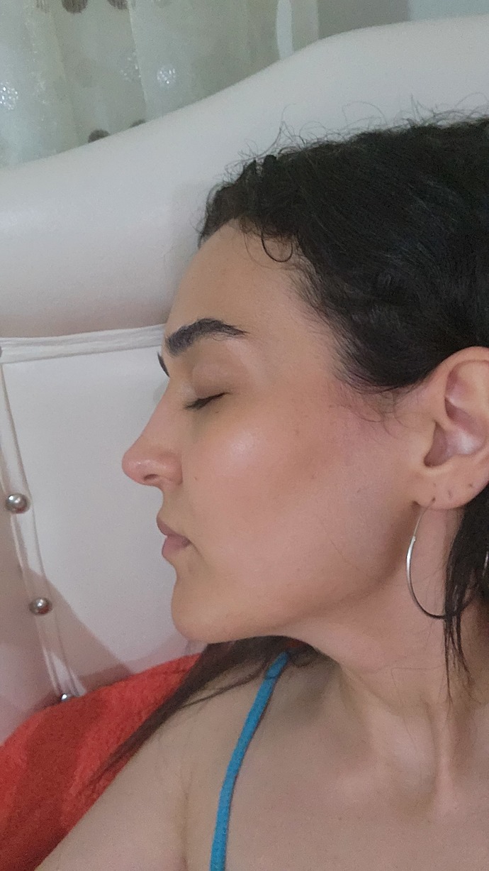 Burun estetiği yaptırayım mı sizce?