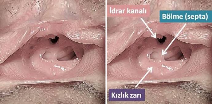 Bakire birinin vajinasının girişi nasil gözükür?
