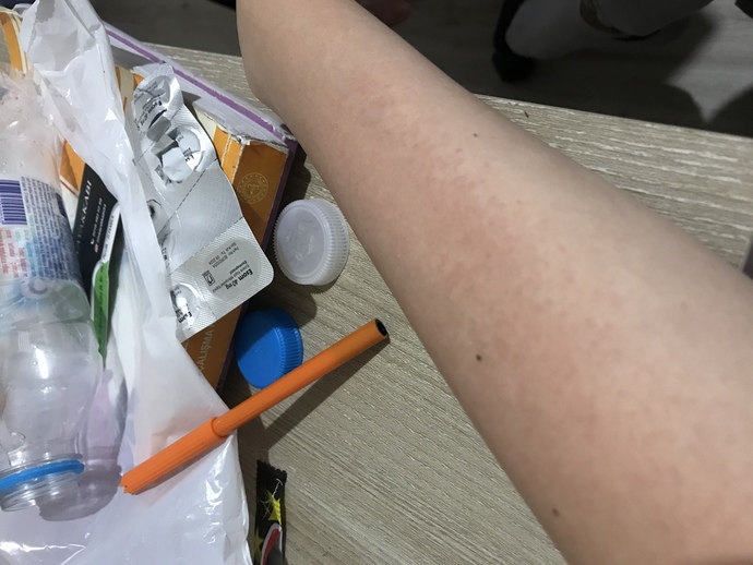 Bu güneş lekesi mi yoksa alerji mi, çok acıyor?