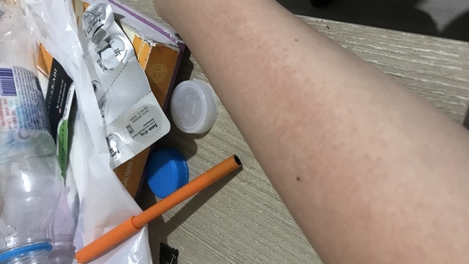 Bu güneş lekesi mi yoksa alerji mi, çok acıyor?