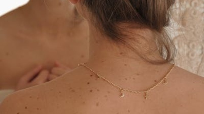 Cildinde ben problemi yaşayanlar 50 spf güneş kremi mi kullanmalı?