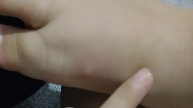 Oğlumun vücudundaki bu şeyler ne olabilir?
