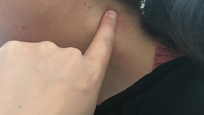 Burası boynun hangi bölgesi?