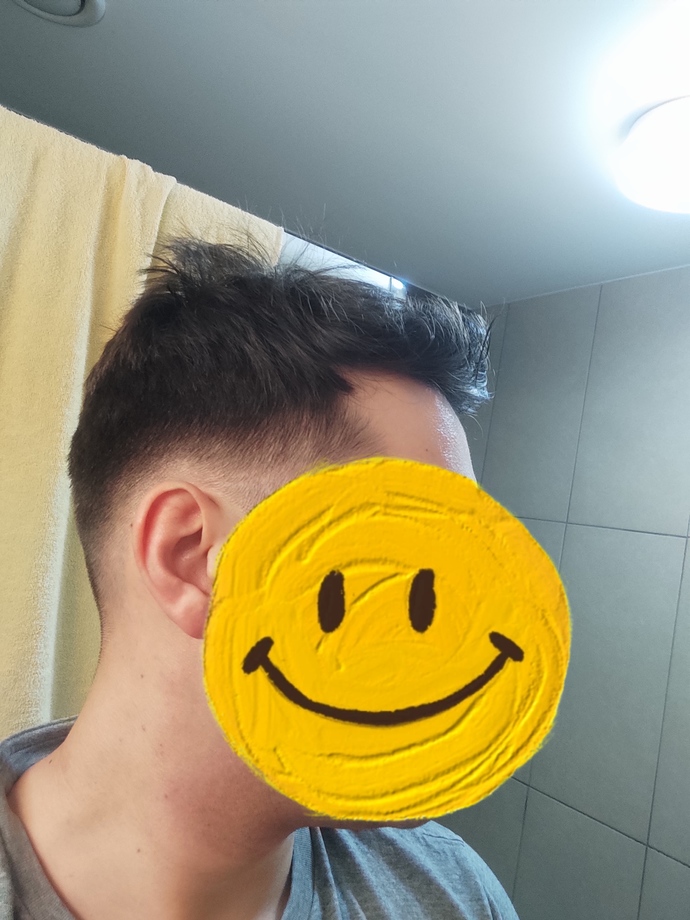 Bu saçta açılma belirtisi var mi?