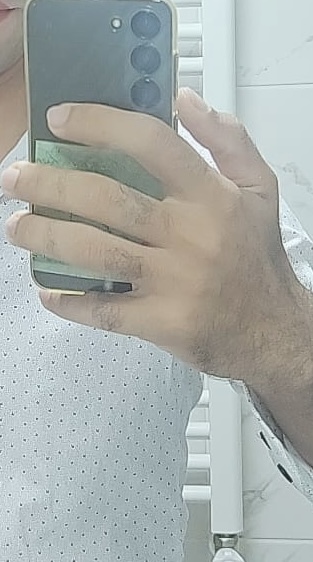 Resimdeki telefonun modeli nedir bilen var mı?